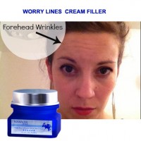 eventually end up with deeper line The best way to avoid Forehead wrinkles horizontal or vertical lines